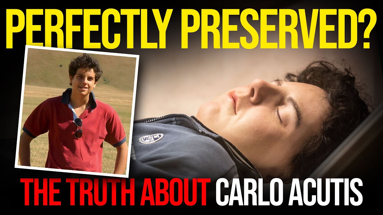 how is carlo acutis preserved