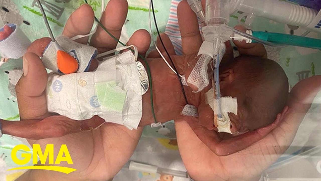 21 Wochen Baby: 5 spannende Entwicklungen, die Sie nicht verpassen sollten 1 21 wochen baby