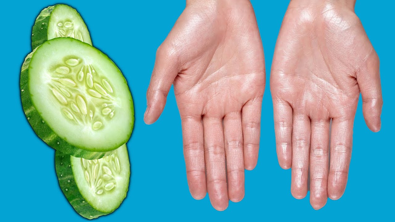 tipps gegen schwitzige hände