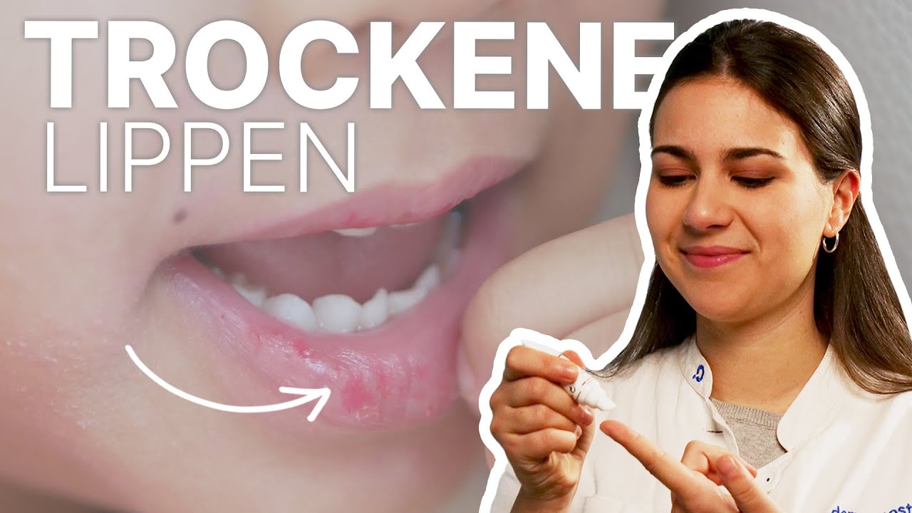 tipps gegen trockene lippen