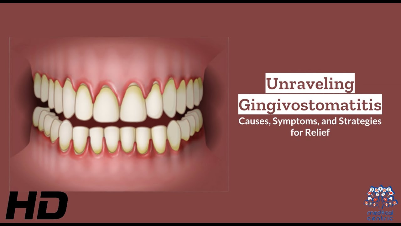 gingivostomatit